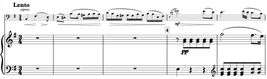  Chopin-Glazunov: Etude-Op25-7 in e Music thumbnail